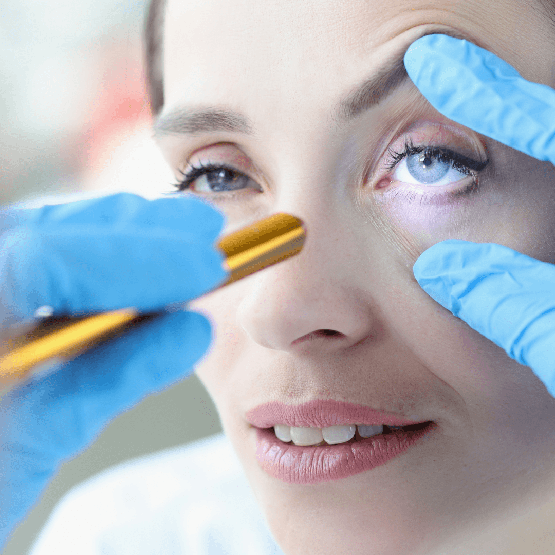 Una persona siendo examinada en el área de los ojos, ojo derecho, por un médico oftalmólogo.